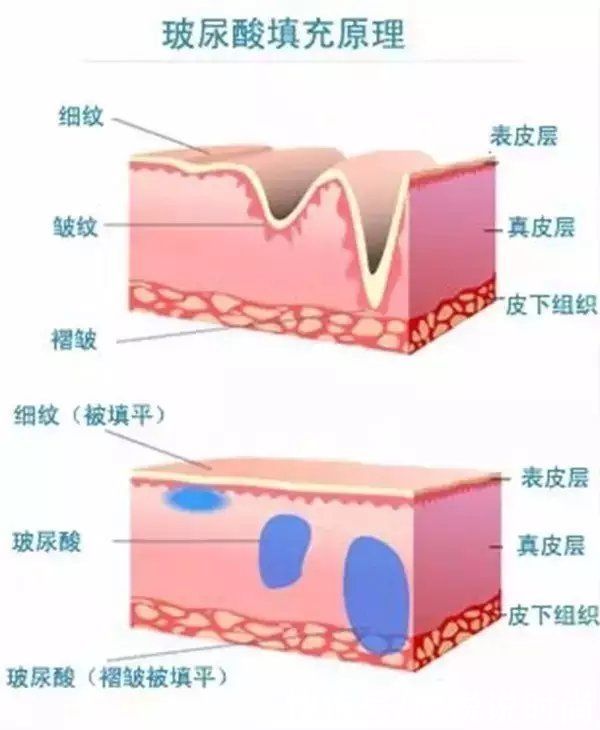 黑眼圈很严重怎么办？怎么拯救特别严重的黑眼圈？