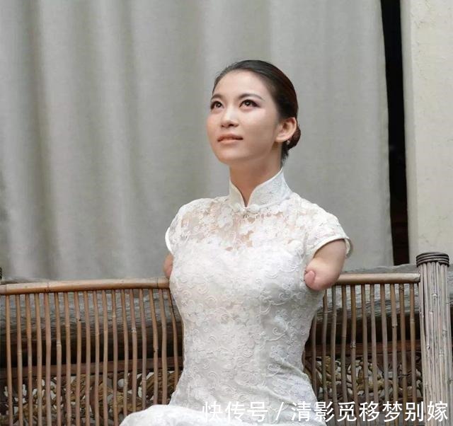 富商|獨臂女孩臺上和富商牽手成功，下臺就被甩，現(xiàn)狀如何