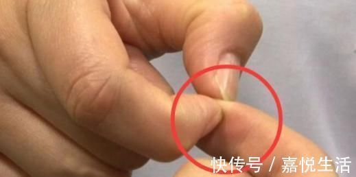 大便|手上有个隐藏“通便按钮”,每天按2下,告别便秘,体重嗖嗖降!