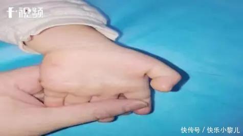 孩子们|3岁女童手指无法屈伸,元凶家家都有,这类“精神鸦片”害娃不浅