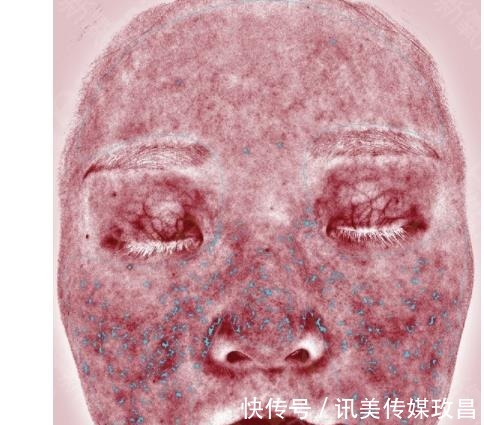 炎症|比“抗衰”更重要!它才是日常护肤的刚需,很多人都做错了