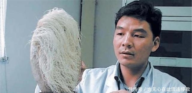直呼|农村老人捡到长满白发的石头,专家见了直呼:立刻封锁整个村庄