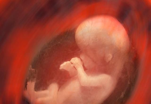 喝水|孕妈这4个坏习惯，可能造成“羊水浑浊”，影响胎儿健康！