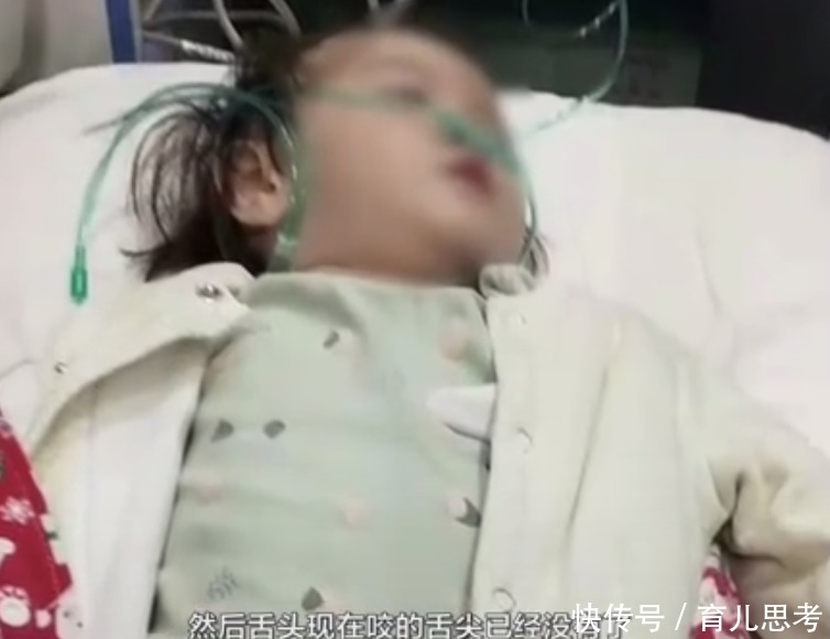 痛觉|三岁女童不会流汗,没有痛觉,并非“超人”,全靠空调保命