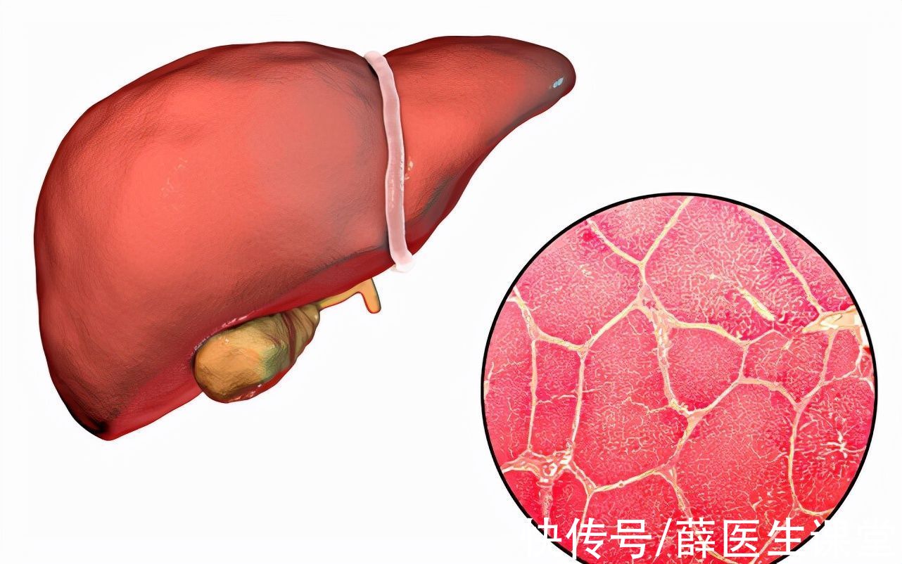 刘芬|32岁女白领，减肥成功，却因肝癌离世，可惜！怎能把“它”当饭吃