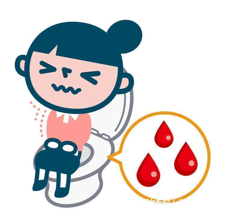 痔疮|屁股出现3大症状,痔疮需要治疗了!试试6招,帮你解决痔疮问题