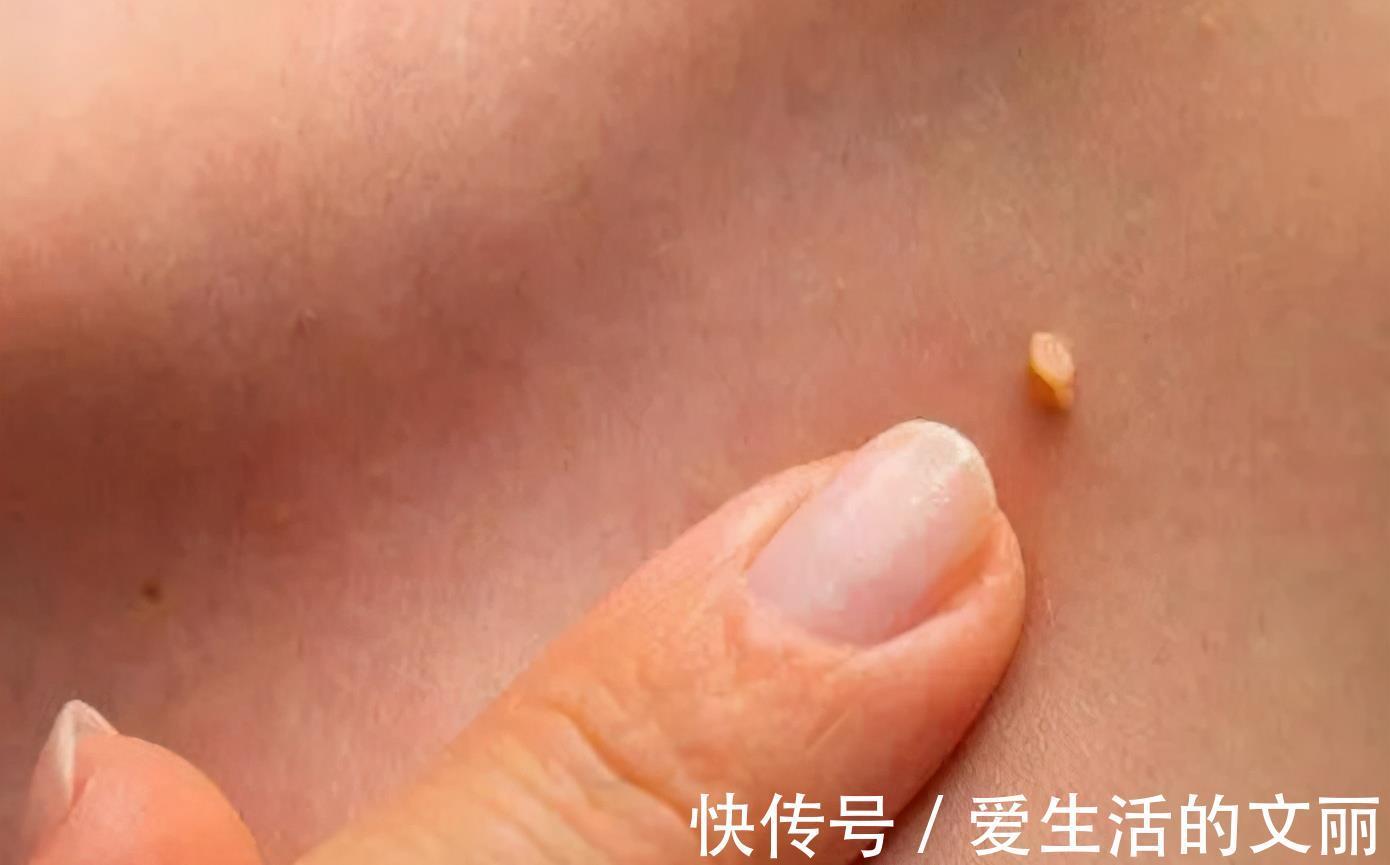 同房|27岁女子查出感染HPV,不久病变,医生直言:3件事怎能天天做