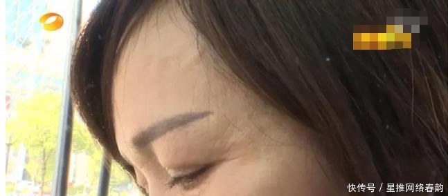 效果|长沙女子花费2万元去皱,结果法令纹依旧,院方:效果因人而异