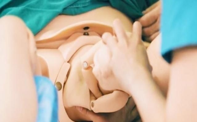 顺产|宝妈吐槽分娩时的尴尬:头胎顺产被“剃毛”,二胎剖腹产也没逃掉