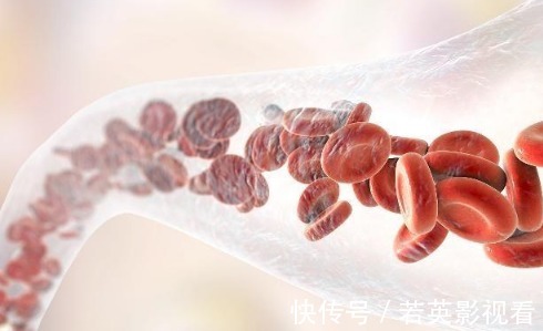 血管堵塞|人的第二个心脏是脚，若是出现了此些迹象，说明血管不通畅了