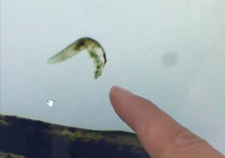 粘合剂|25岁姑娘种完睫毛一个月,去医院一查傻眼了……