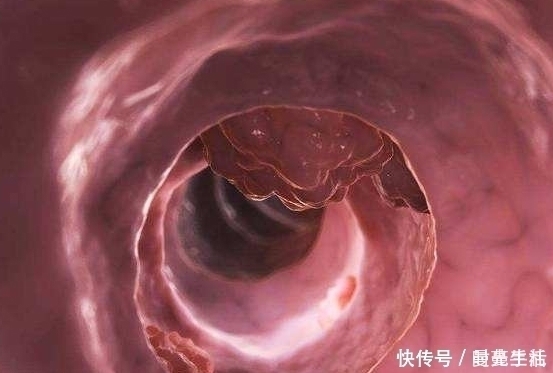 毒素|身上2处“通便穴”,每天睡前按一按,助你缓解便秘,肠道更通畅