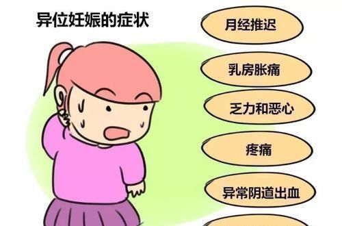 宫外孕|女人怀上“宫外孕”,多半是男人的锅妇产科医生几句话挑出问题