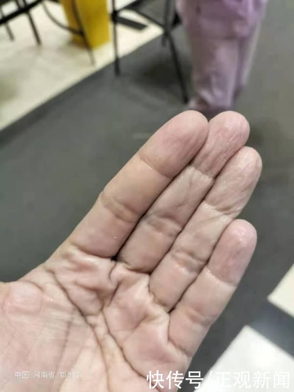 郑州市妇幼保健院|浑身湿透!“最美天使”头上别老冰棍做核酸检测