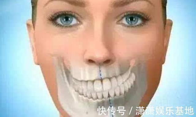 咀嚼|医生直言:5种孩子长大会变“丑”,与遗传无关,希望不是你家娃