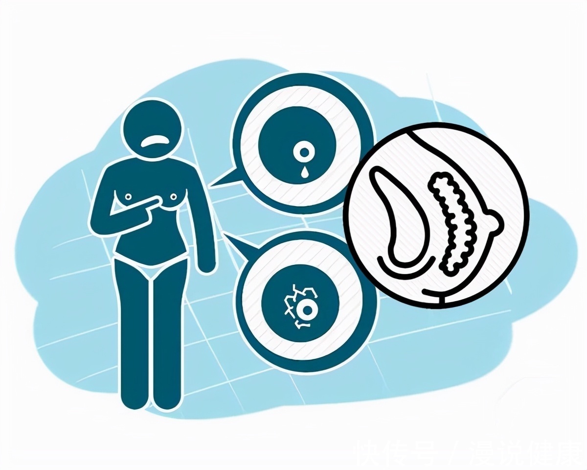 乳腺癌|每76秒就有1人确诊?胸部摸到硬块,除了乳腺癌,还可能是这3种病