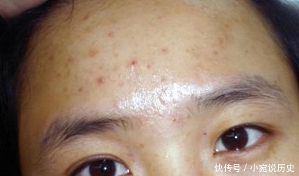 皮肤|皮肤状态差,堪称60岁的老大妈,平时做好3步,肌肤光亮迷人