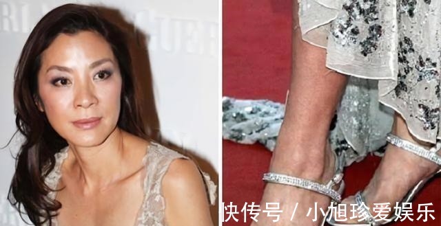 拇囊炎|穿高跟鞋的危害到底有多大?