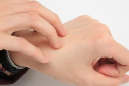 损伤皮肤的行为，很多女性都在做，你一个都没占，或许皮肤很健康