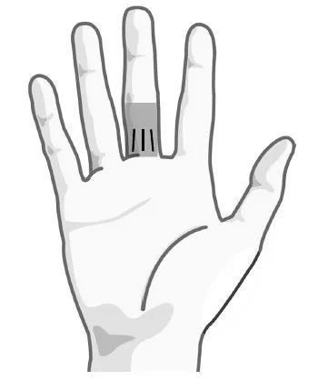 第一附属医院|身体这些部位「青筋凸起」,可能是救命体征