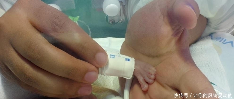 天仙|女婴出生仅280克,被称为“拇指姑娘”,如今14岁貌若天仙