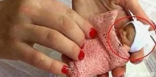 孩子|女孩出生仅1斤“轰动世界”,如今14年过去,结果出现反转