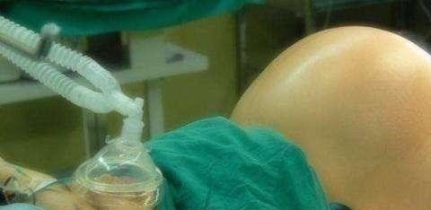 须知|孕妇须知顺产时可能会经历的4个产房“阴影”!看看你最担心哪个