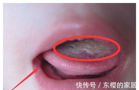 胃脾|11岁女童身高已有163,医生:3种食物是“助长王”,可多吃