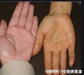 木耳|16岁男孩,查出肝癌,医生怒斥家长:啥东西都敢给孩子吃