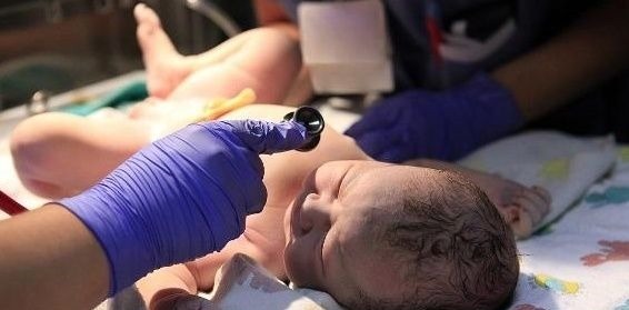 宝宝|剖腹产时,若你赶上这个时间点,或许对产妇和宝宝都好!