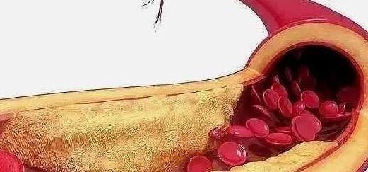 身体|为啥有的人手上的青筋会凸出来青筋越多，对身体有什么影响吗