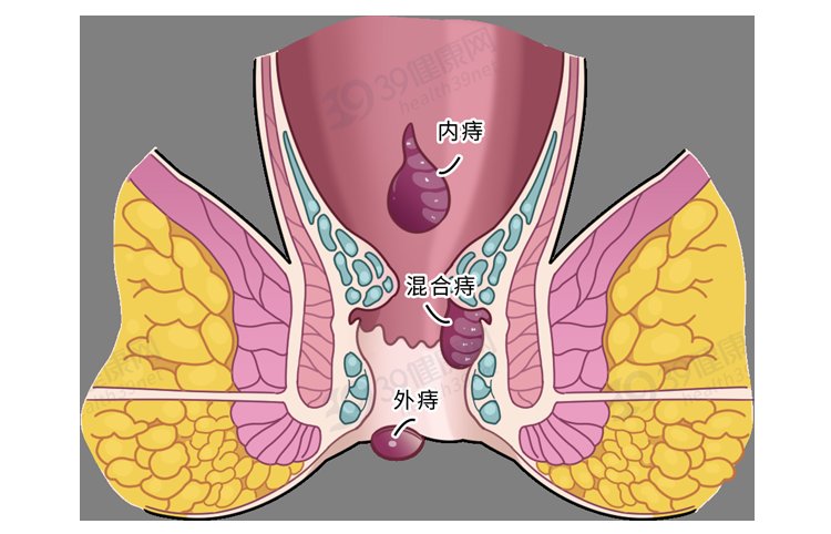 med|保护肛门有多重要？每天清洗肛门可以预防疾病？到底怎么回事？