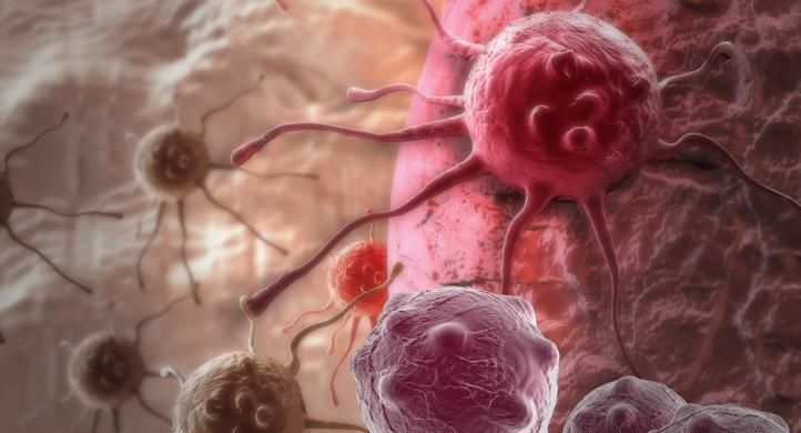 鳞状细胞|4个关于肺癌的真相，听完你可能会感到意外，一起来了解一下