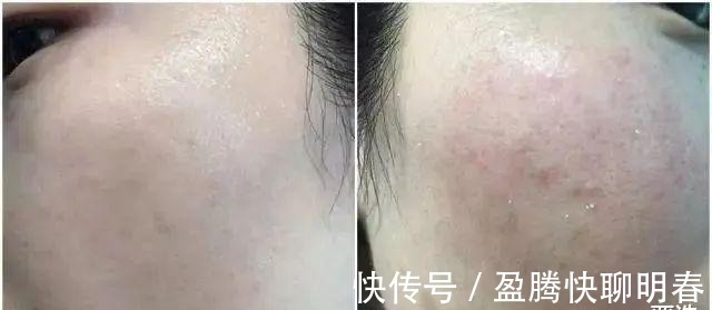 薇娅|能让李佳琦和薇娅看得上,这韩国去角质凝胶,实力真的很强大