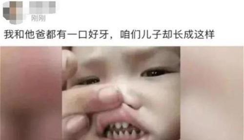 口腔|孩子长了一口“鲨鱼牙”,妈妈着急送医,医生:无知害了孩子
