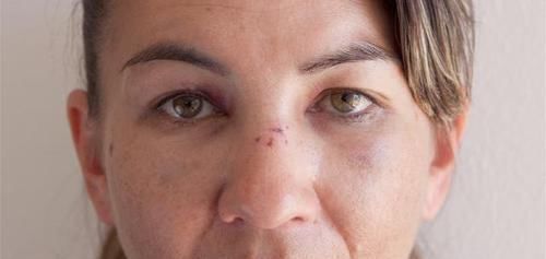 百病|脾虚百病生脾有“三怕”,多吃“一果”,健脾祛湿一步到位