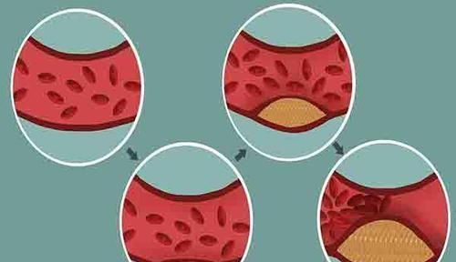 踮脚|每天晚上抽出十分钟踮踮脚，坚持做的人，后来怎么样了？