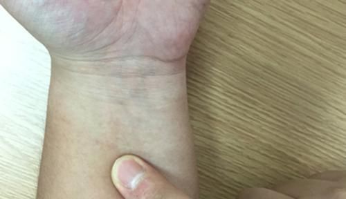 人体有三处“助眠开关”，每天按一按，很快睡着了，跟失眠说拜拜