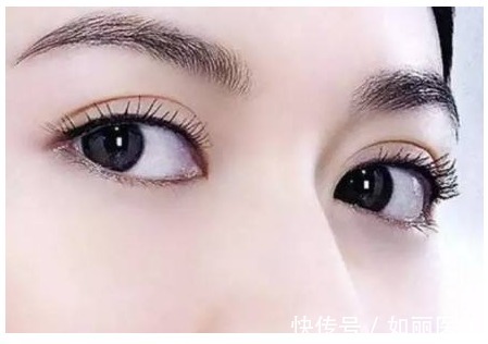 纱布 割双眼皮的注意事项有哪些?做好这些注意事项,术后效果倍棒!