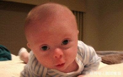 21三体综合症|外国宝妈不顾反对生下“唐氏宝宝”,网友坦言:都有一个共同点!