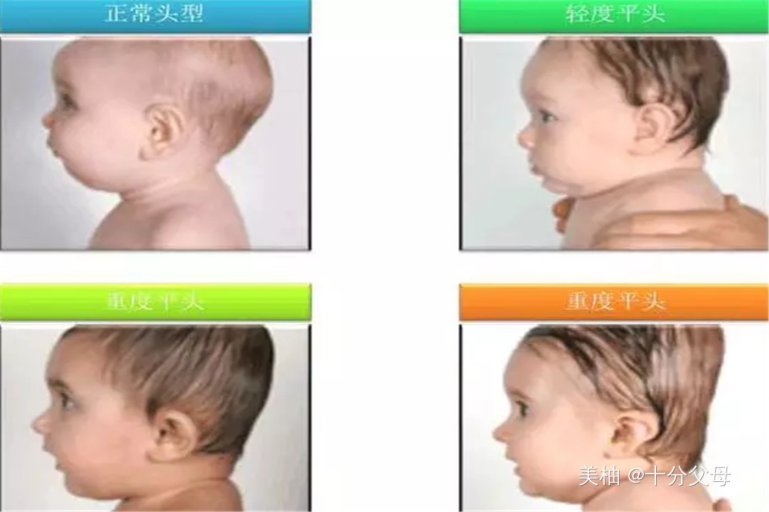 发育|长时间保持这3种睡姿,宝宝头骨易变形,别等到头型定了再后悔