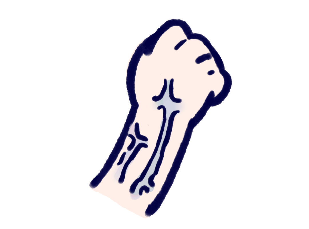 静脉曲张|有些人手臂上“青筋暴起”，有些人却看不到“青筋”？真相来了