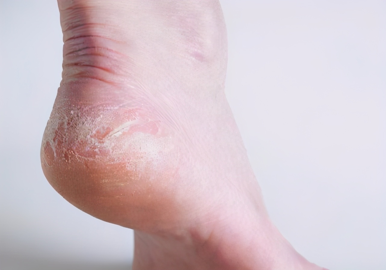 阳池穴|血糖高的人,身体3处有问题,若一个不占,血糖还算稳定