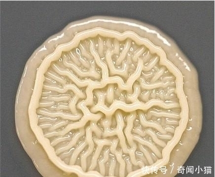 菌落|8岁小孩出去玩,回家不洗手按了个手印,妈妈培养48小时后