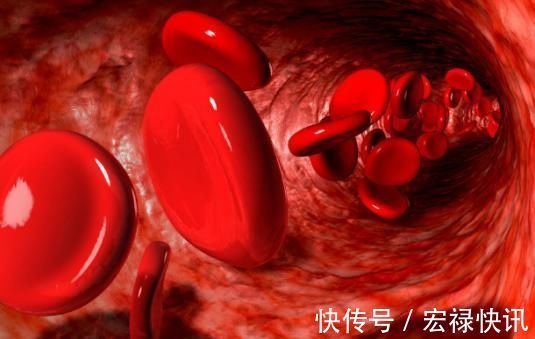 果酒|血稠的“稀释剂”找到了,饭前1口,血液不稠,血管回到十八岁!