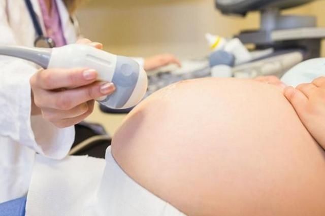 胎盘|孕期子宫内液体被称为“羊水”,为何不是牛水、马水?原来是这样