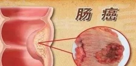 芥末|8种癌都怕这种菜!但99%的人都吃错了,配上它,营养翻倍~