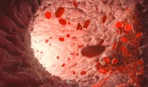 心血管疾病|35岁以上的人,血管越来越堵,1个动作1杯水,让血管干净如初