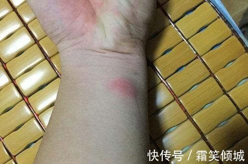 吃药|7幼童感染肺结核医生说先吃药,最少吃六个月,能不能好不一定