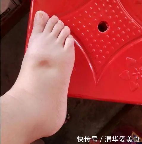 血管|血液粘稠的人,身体2处会发出信号,若没有,血管还比较畅通